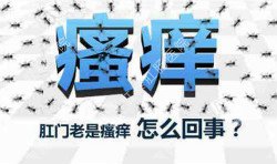 肛門瘙癢治不好嗎？先檢查病因就好辦！